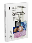 Tumors of the salivary glands